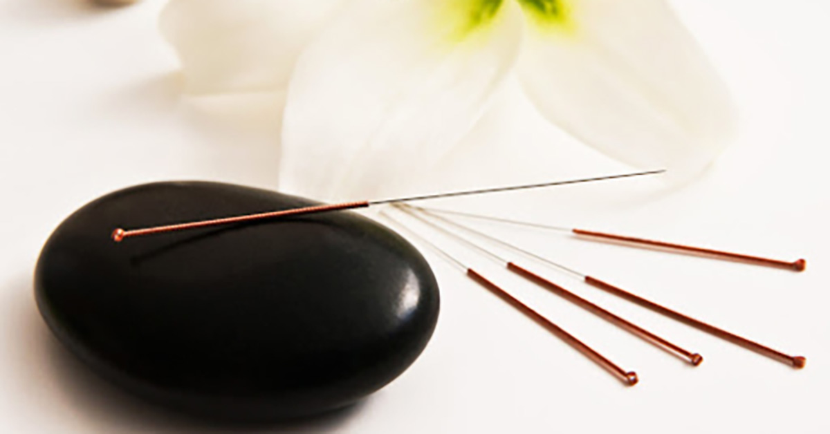 The Beauty Of Holistic Healing Acupuncture Services Spa Bleü West